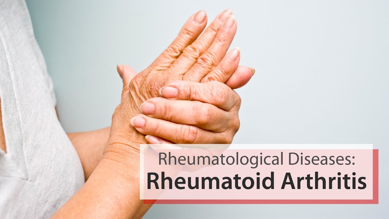 rheumatological-diseases-rheumatoid-arthritis